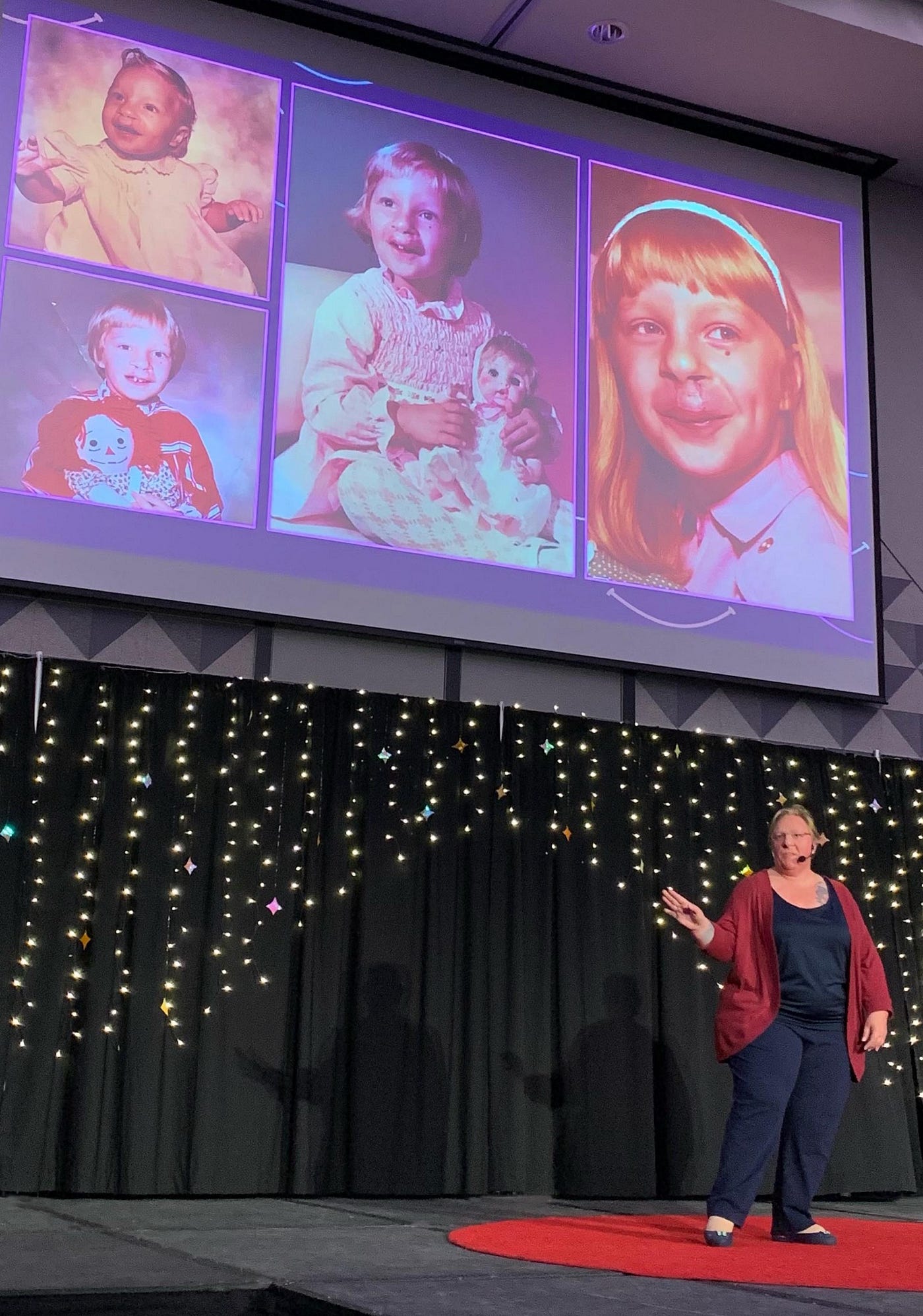 Christine Errico Cleft Lip and Palate Confidence Coach - Giving Her TEDx Talk